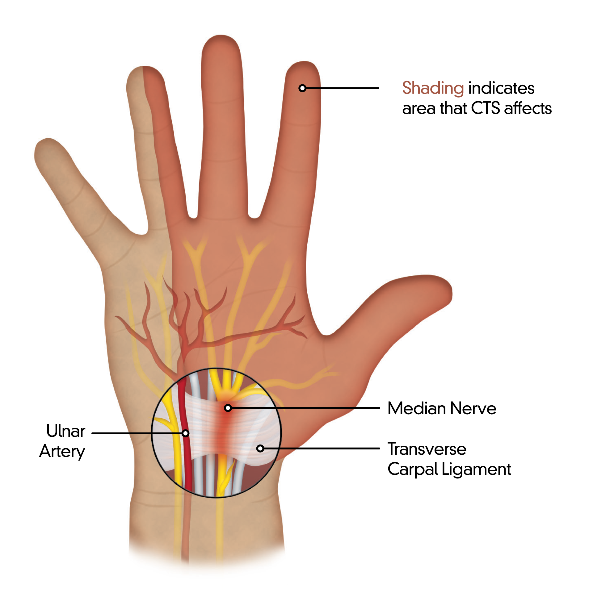 how-doctors-test-for-carpal-tunnel-syndrome